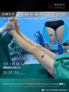 希娅星范大腿环吸，从此拥有理想腿型 - 吾爱微网